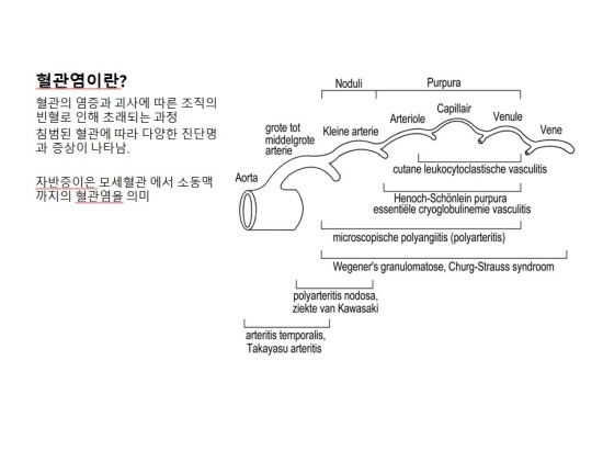 혈관염이란