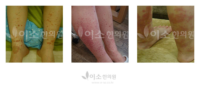 e-so_co_kr_20140220_013758