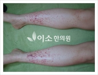 ㄱㅂㄹ_20대_여성_자반_전