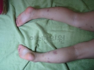 ㅅㅌㅇ_자반_전_후면