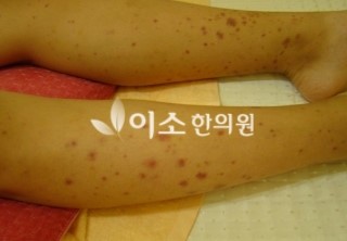 ㅈㅈㅎ_자반_전_양_다리