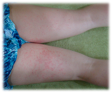 SHH_post_160704_img01